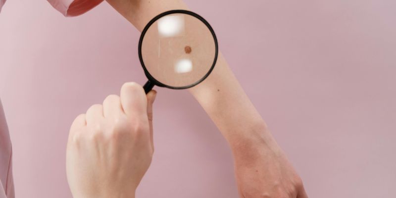 Bí Ẩn Nốt Ruồi Phong Thủy Và Vận Mệnh Chưa Có Lời Giải! 10 Nốt ruồi phong thủy và vận mệnh